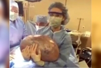 নারীর পেট কেটে আঁতকে উঠলেন চিকিৎসক!