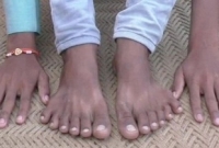 বড়লোক হতে ২৪আঙুলের ছেলেকে বলি দিতে চায় পরিবার!