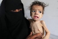 'ইয়েমেনের শিশুরা এতোই দুর্বল যে, কাঁদতেও পারছে না'!