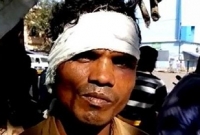 শাশুড়ির কামড়ে কান হারালেন জামাই! 