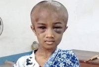 নির্মম নির্যাতনের শিকার শিশু গৃহকর্মী!