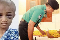 নির্যাতনের শিকার শিশু লামিয়ার পাশে পুলিশ কমিশনার, জড়িত গৃহকর্তাকে খুজছে পুলিশ