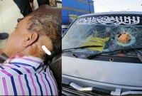 হাটহাজারীতে ঐক্যফ্রন্ট প্রার্থী সৈয়দ ইব্রাহিমের গাড়ি বহরে হামলা