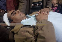 গোলাম মাওলা রনি আহত গোলাম মাওলা রনি আহত