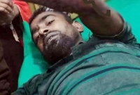  প্রাণ বাঁচাতে বাঘের সঙ্গে আধাঘন্টা লড়াই!