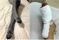 বিছানায় স্ত্রীকে সাপ ভেবে ব্যাট দিয়ে বেধড়ক পেটালেন স্বামী!