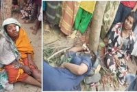 শিকল বেঁধে ৩ নারীকে অমানুষিক নির্যাতন, কেটে দেয়া হলো চুল, ভেঙ্গে দেয়া হয়েছে হাত-পা