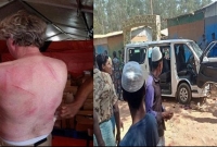 বিদেশি সাংবাদিকদের বেধড়ক পিটিয়ে ক্যামেরা, কাগজপত্র ছিনিয়ে নিল রোহিঙ্গারা