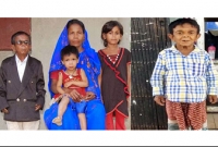 ১৩ কেজি ওজনের চেরাগ আলীর জীবনের গল্প