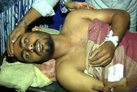 এবার সোনাগাজীতে যুবককে হাত-পা বেঁধে পুড়িয়ে মারার চেষ্টা