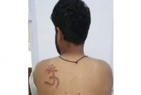 ভারতে মুসলিম বন্দির গায়ে গরম লোহা দিয়ে লেখা হলো হিন্দুদের ধর্মীয় চিহ্ন ‘ওঁ’