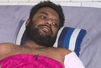 ২১ তলা থেকে পড়ে গিয়েও অবিশ্বাস্যভাবে বেঁচে আছেন রেজোয়ান