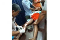 প্যান্টের পকেটে অ্যান্ড্রয়েড মোবাইল বিস্ফোরণ!