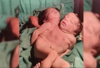 জোড়া মাথা সদ্যোজাতের জন্ম দিলেন জাহানারা! জন্মের কিছুক্ষণের মধ্যেই মৃত্যুতে চাঞ্চল্য