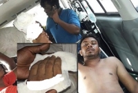 সাবেক ছাত্রলীগ নেতার চারটি আঙুল কেটে নিল বর্তমান ছাত্রলীগ নেতারা