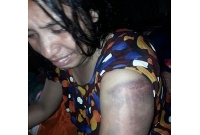 যৌতুকের কারণে শিক্ষক স্বামীর পিটুনিতে শিক্ষিকা স্ত্রী মুমূর্ষু