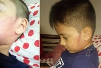 খতনার সময় ওটিতে কান্নাকাটি করায় ৫ বছরের শিশুকে পেটালেন চিকিৎসক!