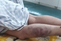 যুবককে থানায় ঝুলিয়ে অমানুষিক নির্যাতন, বরখাস্ত ৪ পুলিশ