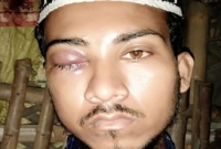 ‘জয় শ্রীরাম’ বলতে রাজি না হওয়ায় মাদরাসাছাত্রকে বেদম প্রহার