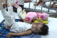 পুতুলের ইনজেকশন নেয়া দেখে অ’স্ত্রোপচারে সম্মত হলো শিশুটি!