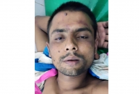 মায়ের  হাত-পা বেধে শরীরে পেট্রোল ঢেলে আগুন দিয়েছে ছেলে!