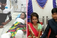 বিয়ের আগেই পুড়ে গেছে সারা শরীর, তবু সেই মেয়েকেই বিয়ে করবে হবু বর!