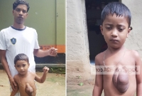 বুকে ঝুলছে শিশু আরাফাতের হৃদপিন্ড! বুকে ঝুলছে শিশু আরাফাতের হৃদপিন্ড!