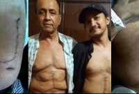 বাবাকে বাঁচাতে নিজের ৭০% লিভার দিলেন ভৈরবের এক তরুণ!