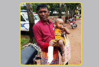 শিশুর ভাঙা পা রেখে ভালো পায়ে প্লাস্টার!