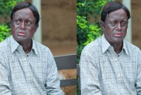 বিরল রোগে আ'ক্রান্ত আ.খ.ম হাসান!