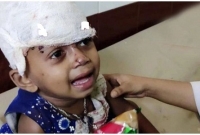 কাউকেই খুঁজে পাচ্ছে না ট্রেন দুর্ঘটনায় আহত শিশুটি, একেবারেই একা হয়ে পড়েছে