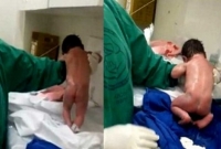 আশ্চর্য ঘটনা, ভূমিষ্ঠ হয়েই হাঁটতে শুরু করলো এই সদ্যজাত শিশুটি! আশ্চর্য ঘটনা, ভূমিষ্ঠ হয়েই হাঁটতে শুরু করলো এই সদ্যজাত শিশুটি!