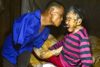 হাত নেই, তবুও ২৮ বছর ধরে এভাবেই বৃদ্ধ মা’কে খাওয়ান এক প্রতিবন্ধী