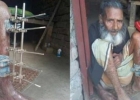 টাকার অভাবে শরীরে রড বয়ে বেরাচ্ছেন ৮৫ বছরের এই অসহায় মানুষটি!