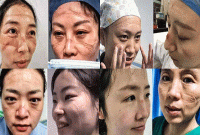 চীনে ডাক্তার-নার্সদের মুখের দিকেই তাকানো যাচ্ছে না!