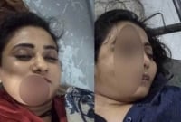   সড়ক দু'র্ঘটনায় মহাখালীতে দুই নারী নিহ'ত, এখনও পরিচয় জানা যায়নি