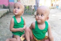 বাবার পরে মায়ের মৃত‌্যু, অসহায় যমজ শিশু