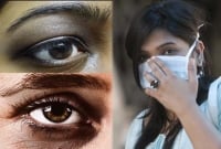 চোখ দেখেই বোঝা যাচ্ছে সেই ব্যক্তি করোনায় আক্রা'ন্ত কি না!