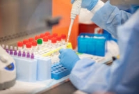   অত্যাধুনিক প্রযুক্তির পর এবার করোনার ওষুধ আবিষ্কার করল ইরান