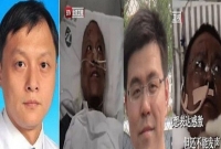 করোনাভাইরাস: ফর্সা থেকে কুচকুচে কালো হয়ে গেলেন দুই চিকিৎসক