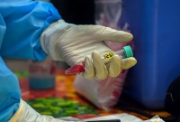 ভাবা হচ্ছিল করোনার মহৌষধ, প্রথম পরীক্ষায় ফেল করল...