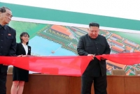 তিন সপ্তাহ পরে জনসম্মুখে, কিম জং উনের কব্জিতে রহস্যময় ছিদ্র