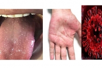 করোনার মধ্যেই নতুন এক রোগের হা'না, দিশেহারা যুক্তরাজ্য