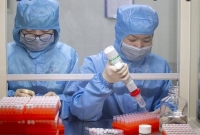 যে দেশই করোনার টিকা প্রথমে আবিষ্কার করতে পারবে, সে দেশই বিশ্বে ছড়ি ঘোরাবে