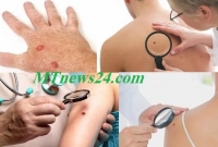 আপনার শরীরে এটি দেখা দিয়েছে, অবহেলা নয়, তাড়াতাড়ি ডাক্তার দেখান