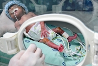  কোমায় গিয়েও সুস্থ সন্তান জন্ম দিলেন করোনা আক্রা'ন্ত নারী!