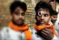 জো'রে বাইক চালানোর শা'স্তি স্বরুপ যুবকের কপালে চাবি ঢুকিয়ে দিলো পুলিশ! 