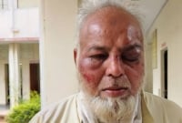 ‌‘‌জয় শ্রী রাম’, ‘‌মোদি জিন্দাবাদ’ না বলায় মুসলিম অটোচালককে বেধ'ড়ক মা'র