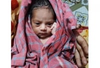 পরিত্যক্ত ব্যাগে জীবিত নবজাতক, খাচ্ছিল পিঁপড়ায়!