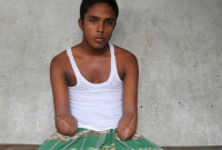 পল্লী বিদ্যুতের লাইন মেরামতের কাজ করতে গিয়ে ২ হাত হারিয়ে ডুকরে ডুকরে কাঁদছেন সাব্বির